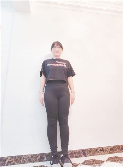 高女士減脂前后對(duì)比。